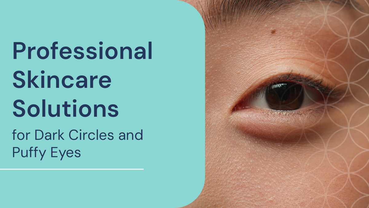 Professional Skincare Solutions for Dark Circles and Puffy Eyes